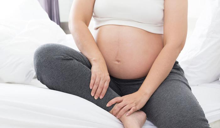 How to deal with varicose veins during pregnancy