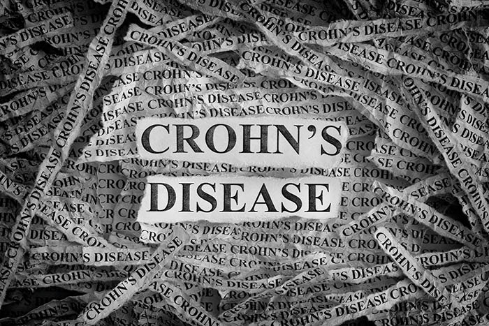 Know about Crohn's Disease