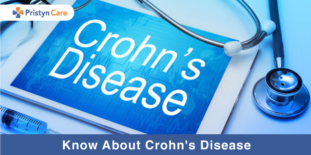 Know about crohn's disease