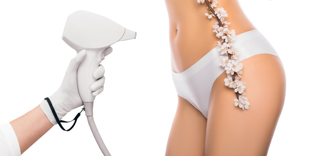 Laser Hair Removal at Home