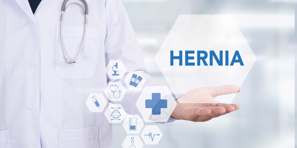 Possible treatments for Hernia