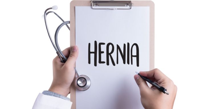 Precautions to be taken after Hernia Surgery