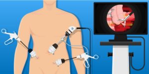 Qualities of a Laparoscopic Surgeon a patient can look for