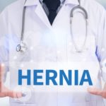Role of Laparoscopy to Treat Hernia Effectively