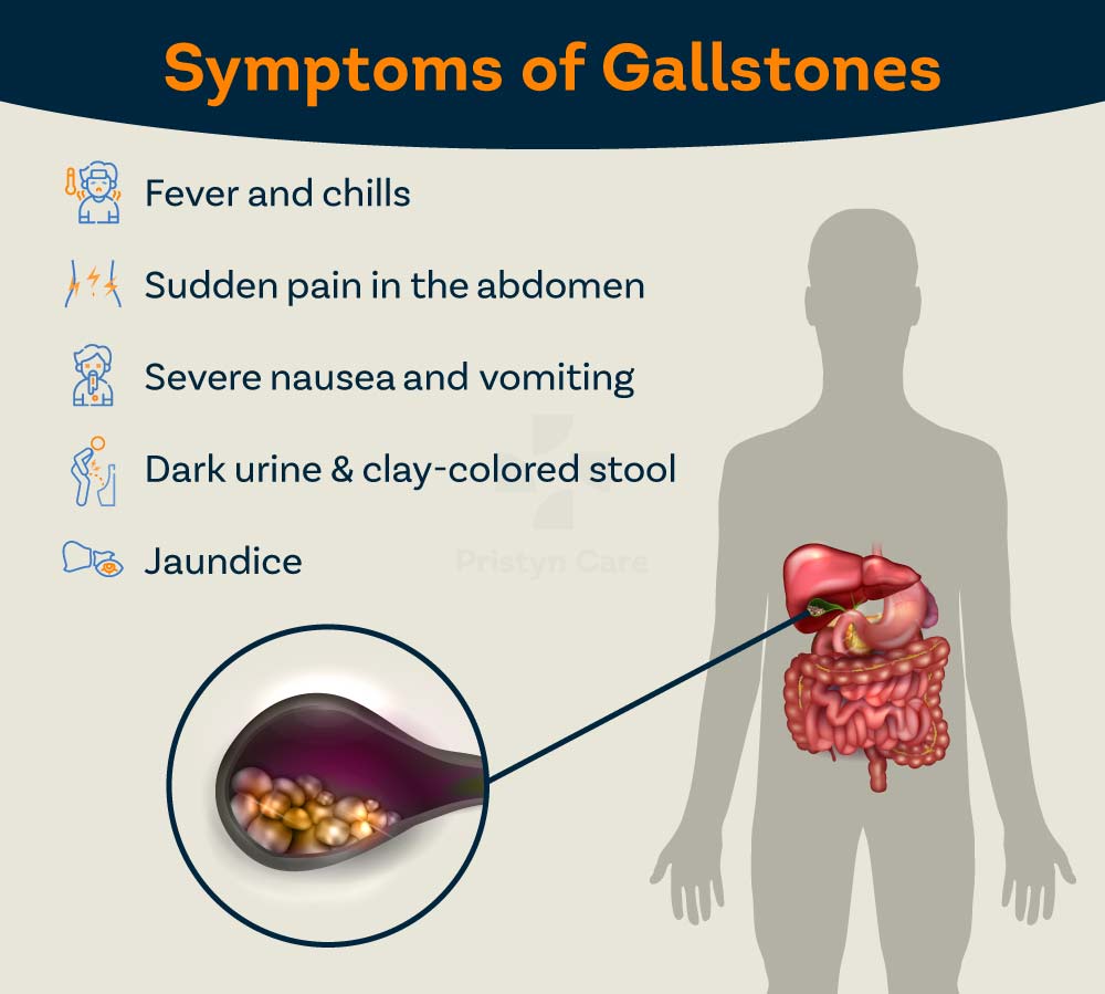 Gallstones Symptoms
