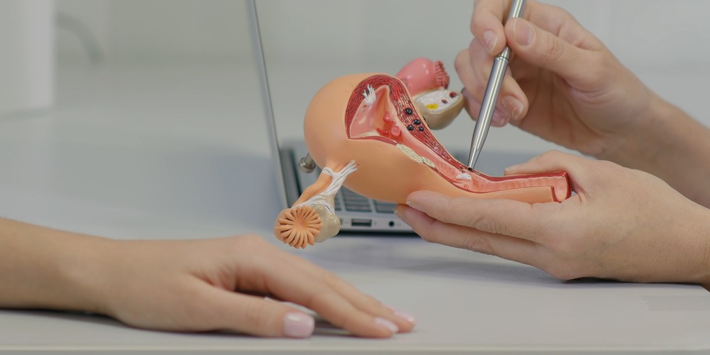 What all you need to know about hysterectomy