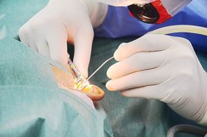 Why is surgery better - Pristyn care