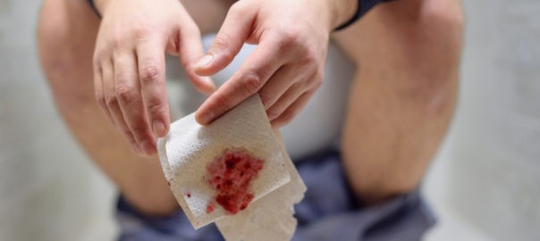 Why is There Blood in Your Stool?