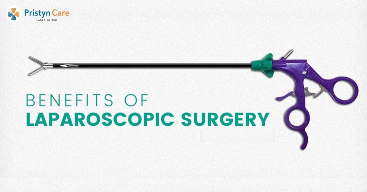Benefits of Laparoscopic Surgery 30 Min Procedure
