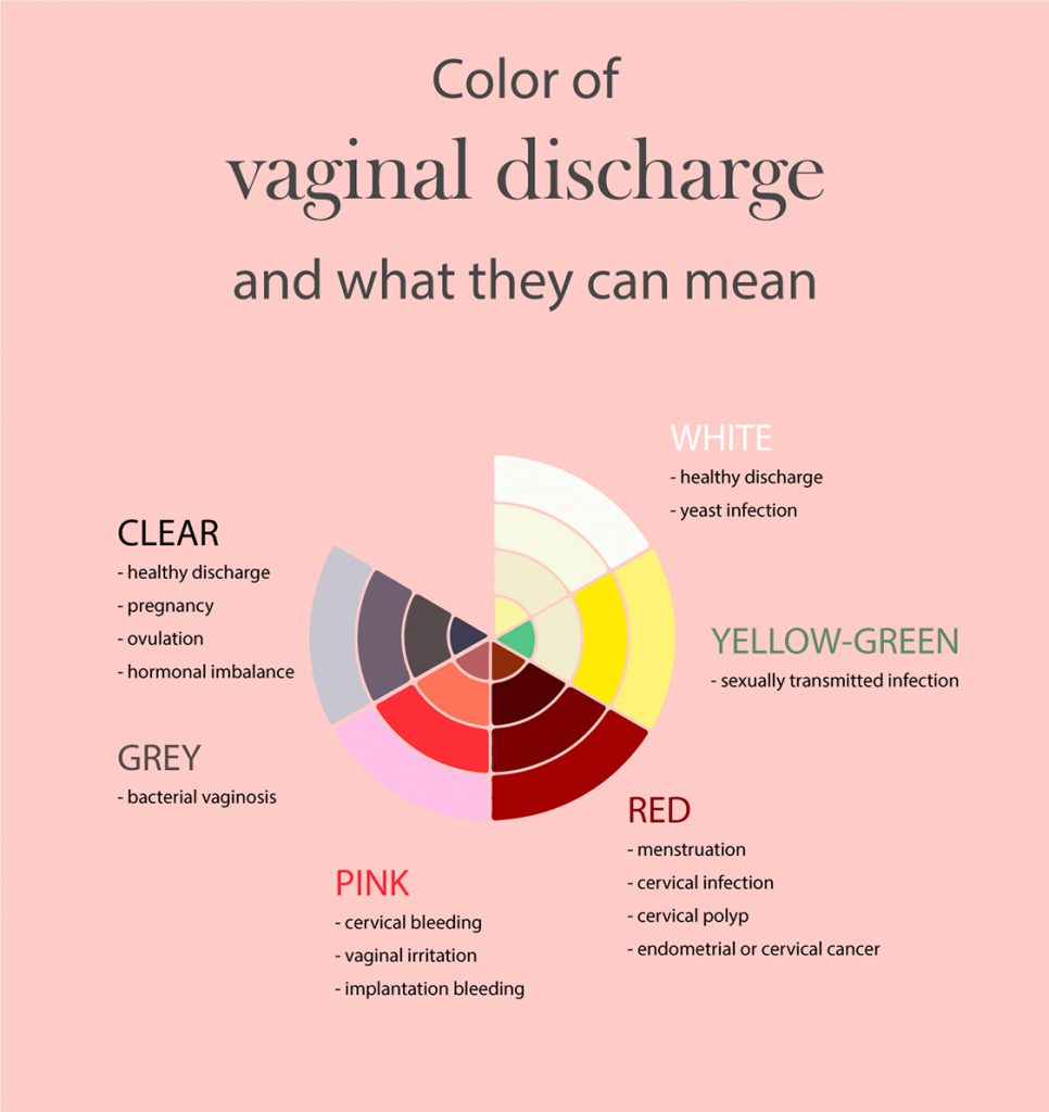 vaginal discharges ocolors and their meaning