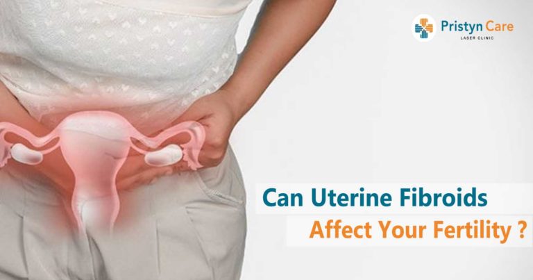 can-uterine-fibroids-affect-your-fertility