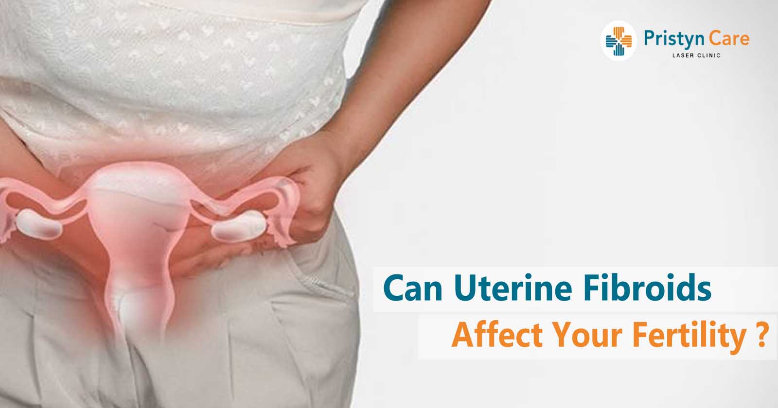 can-uterine-fibroids-affect-your-fertility