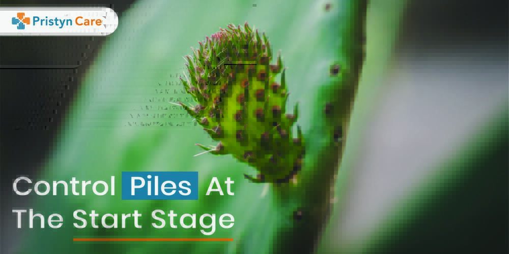 control Piles At Start - pristyn care