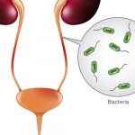 urinary tract infections