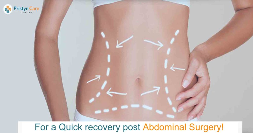 For a Quick Recovery Post Abdominal Surgery!