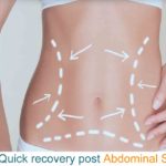 for-a-quick-recovery-post-abdominal-surgery