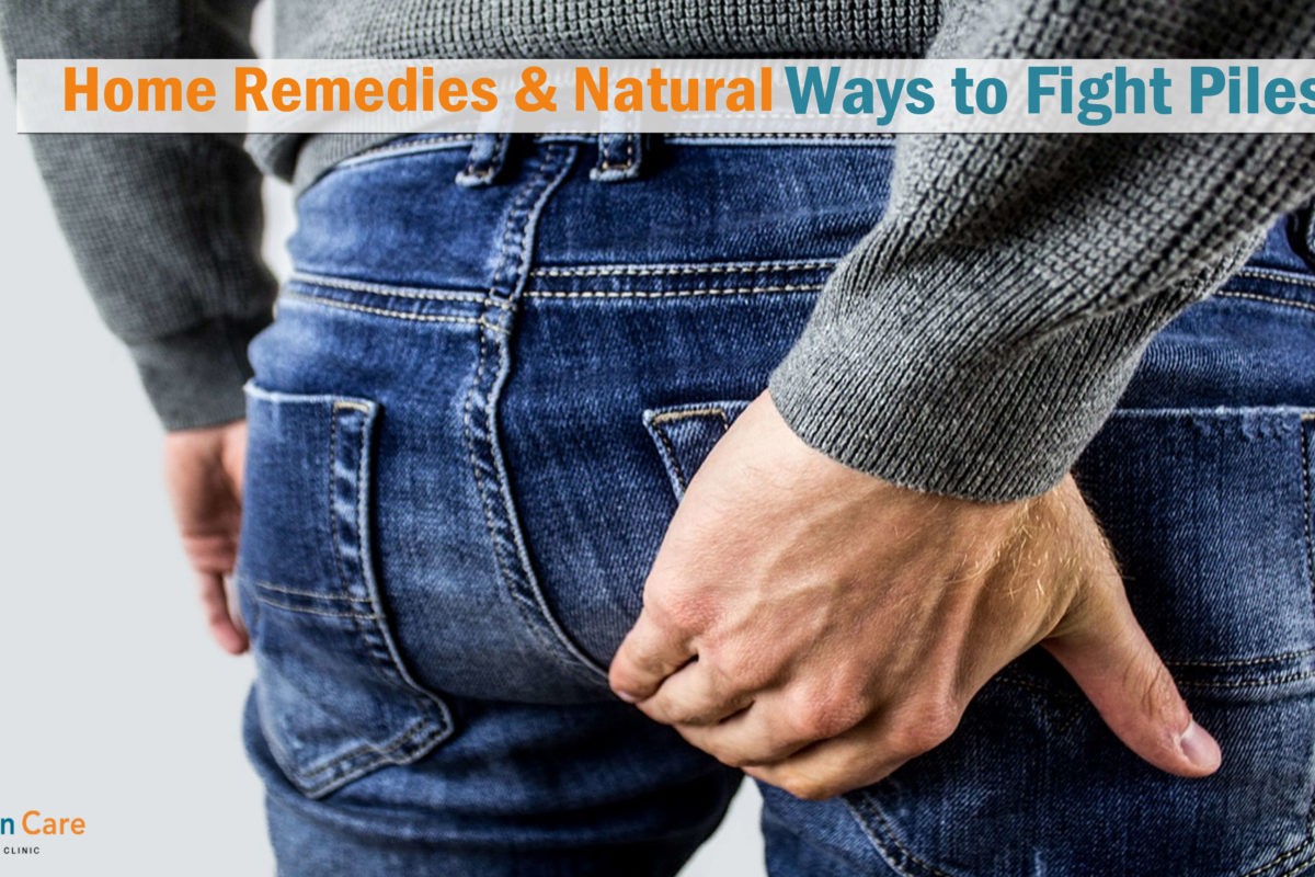 Home Remedies & Natural Ways to Fight Piles