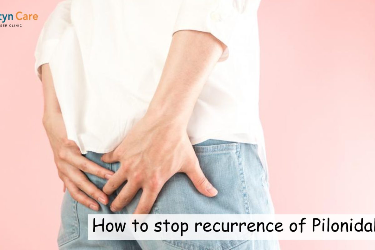 How to stop recurrence of Pilonidal Cyst