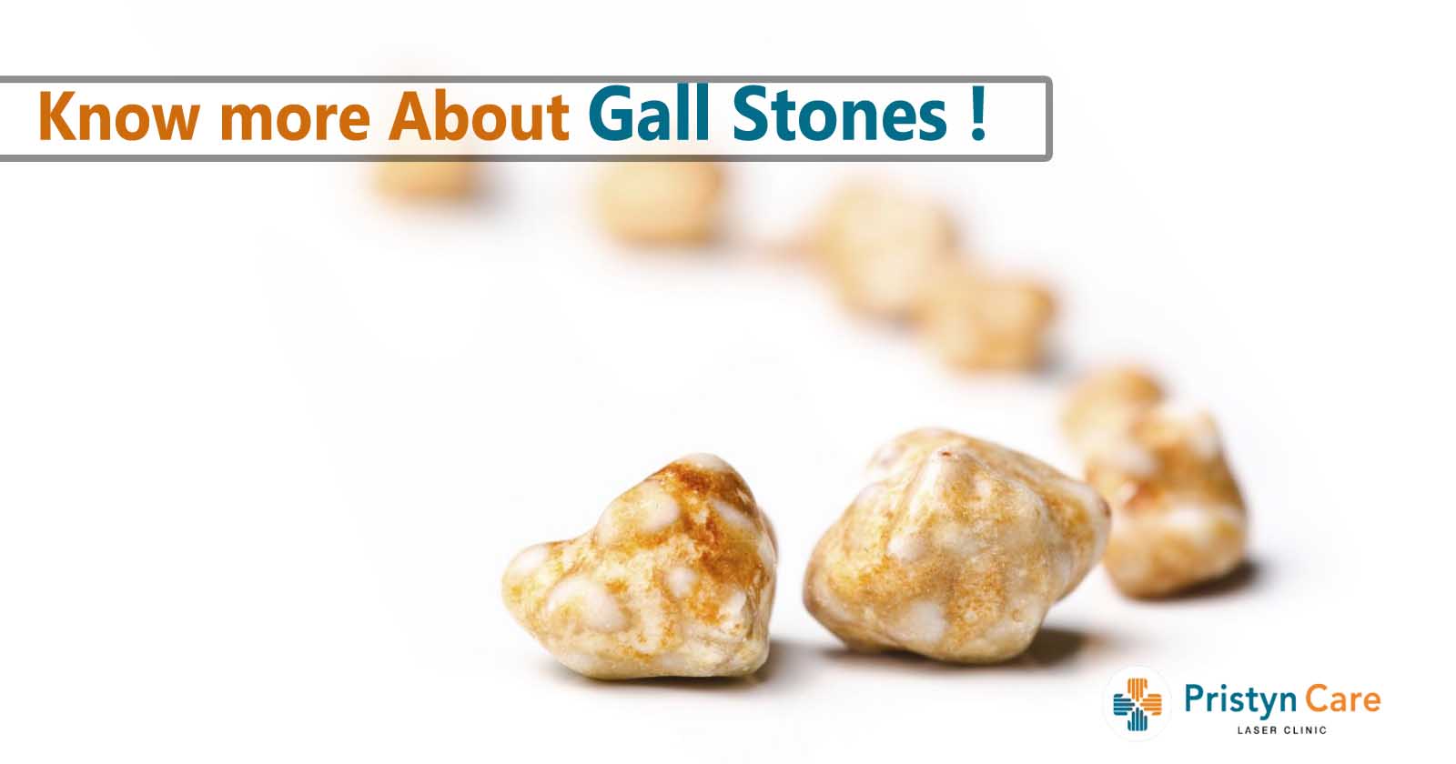 know-more-about-gall-stones