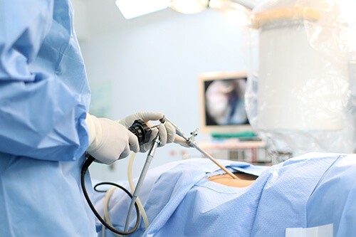 How Long Does Laparoscopic Surgery Recovery Take