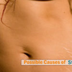 possible-causes-of-stretch-marks