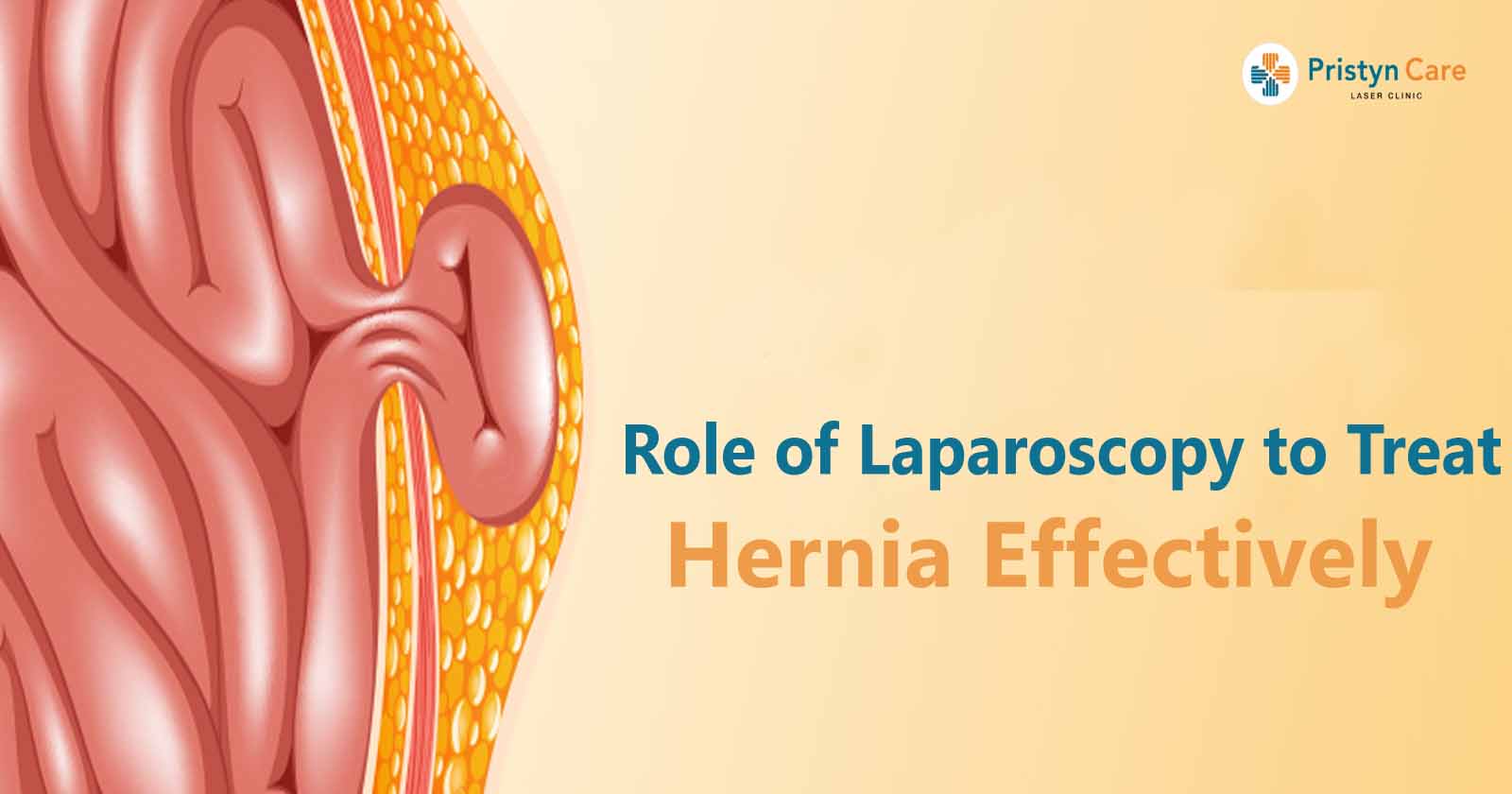 role of laparoscopy