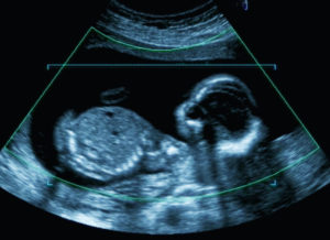 mother undergoes an ultrasound