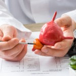 Risk Factors and Prevention for Prostate Enlargement