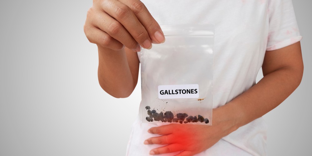 How Prevalent Gallstones Are In India?