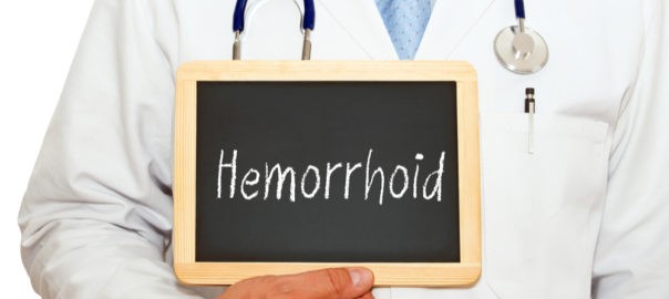 15 Fastest Ways to Get Rid of External Hemorrhoids