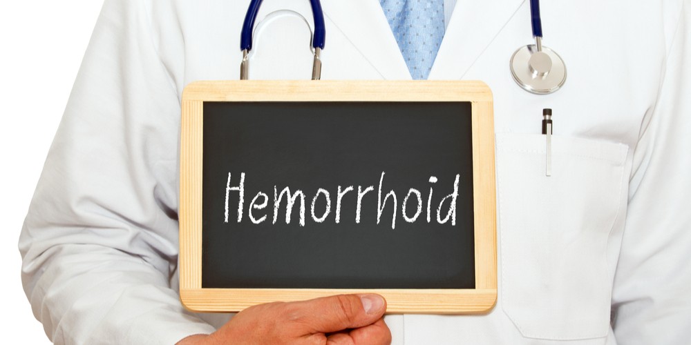 15 Fastest Ways to Get Rid of External Hemorrhoids