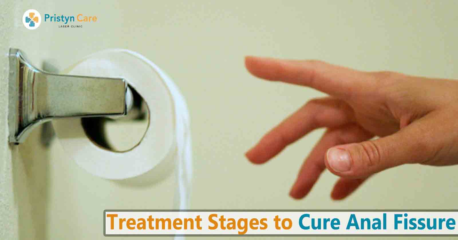treatment for anal fissure