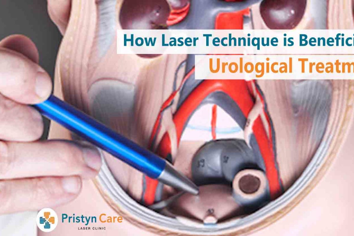 How Laser Technique is Beneficial For Urological Treatment