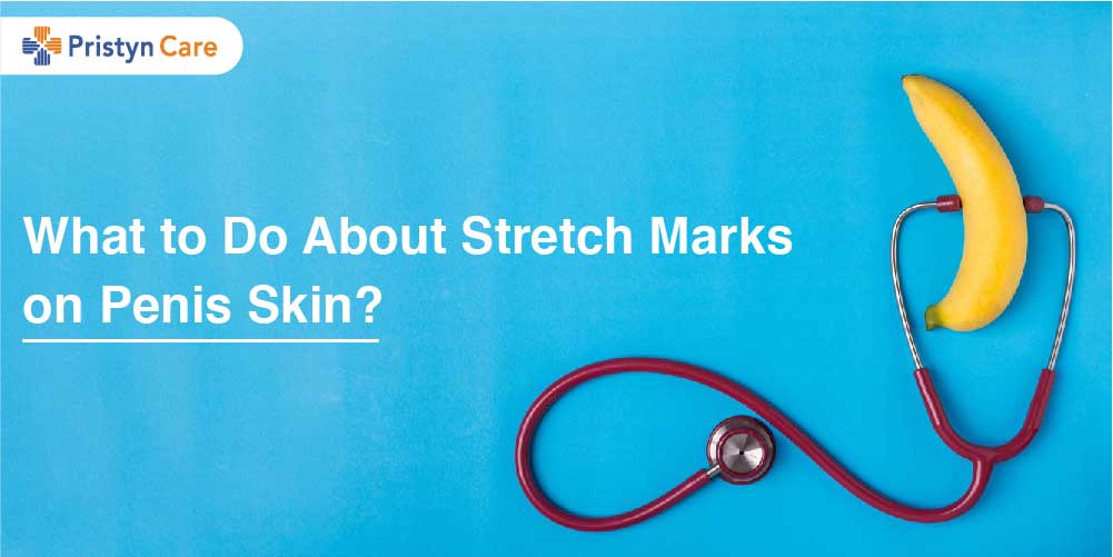 What to Do About Stretch Marks on Penis Skin? - Pristyn Care