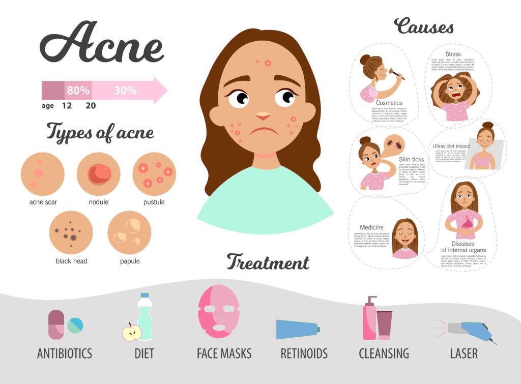 Home remedy acne