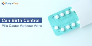 Birth control pills | varicose veins | Pristyn Care