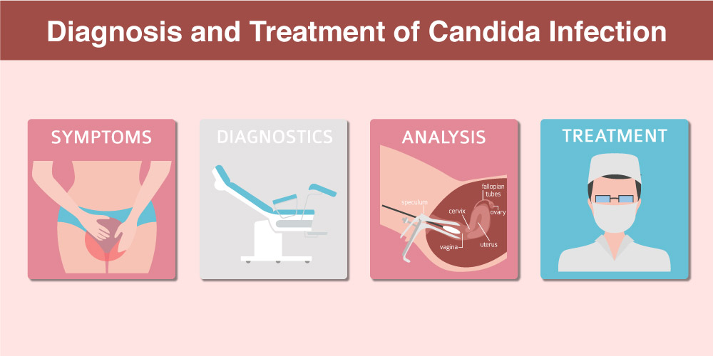 Diagnosis and Treatment of Candida infection
