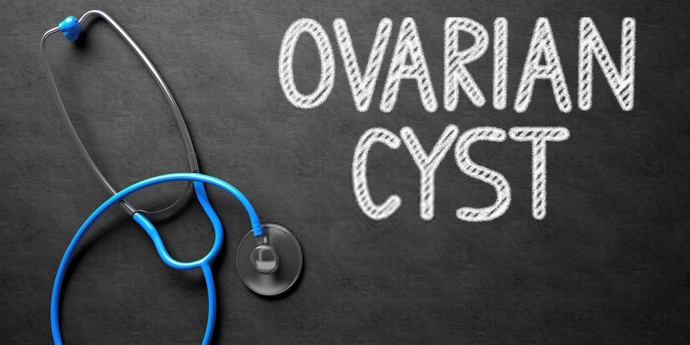 Ovarian Cyst