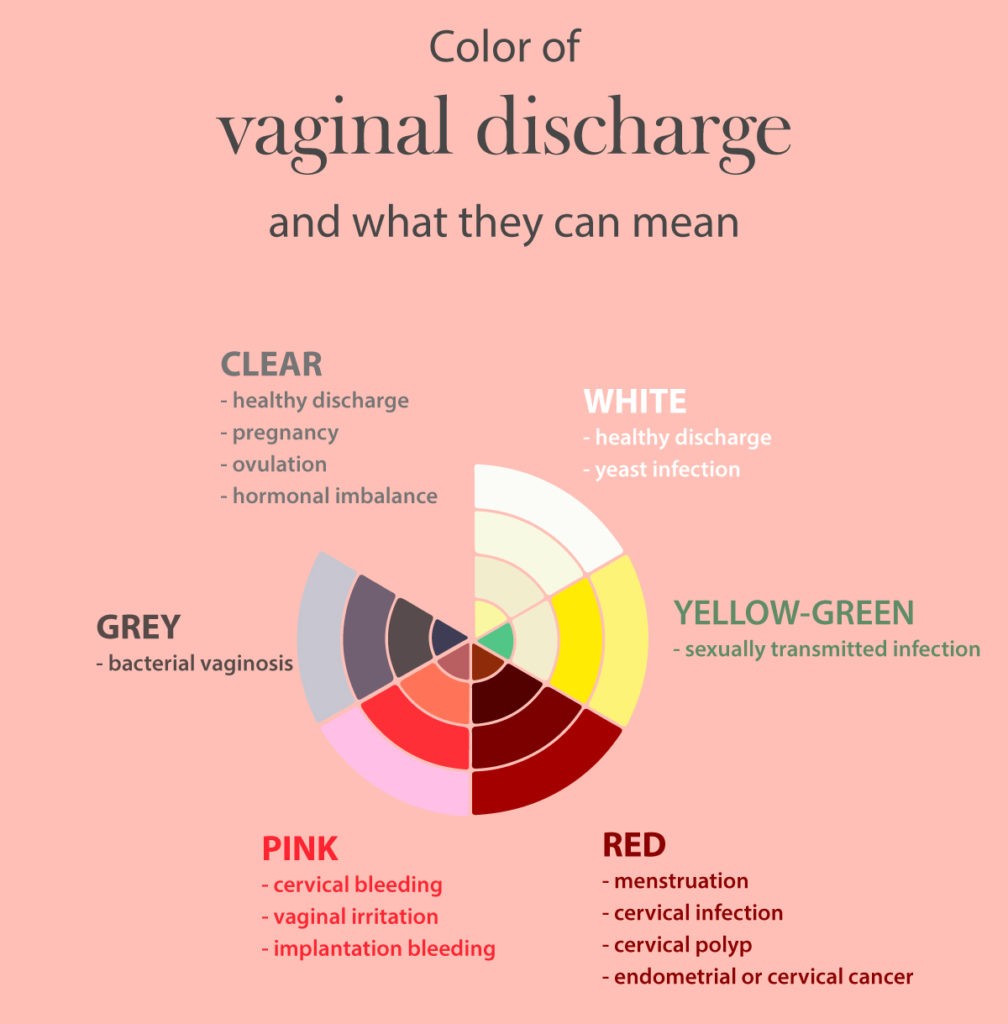 types of vaginal discharge 