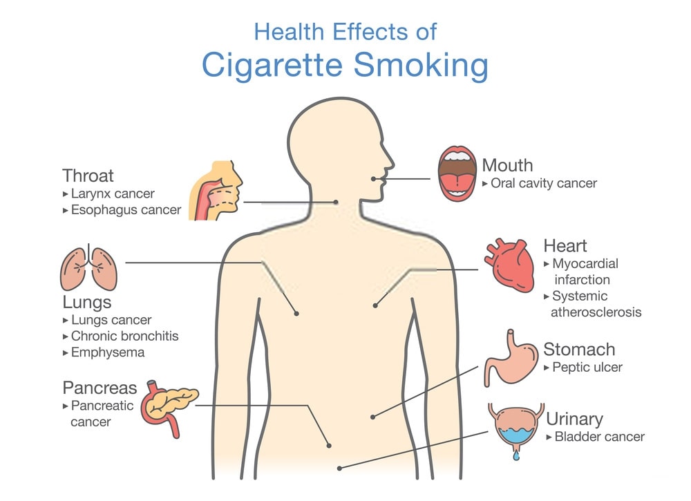 The Pathophysiology Of Smoking And Heart Attack Pristyn Care