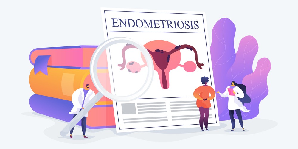 Endometriosis