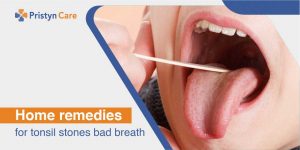 Home Remedies For Tonsil Stones And Bad Breath