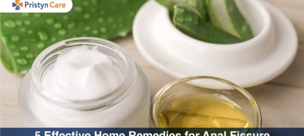 5 Effective Home Remedies for Anal Fissure
