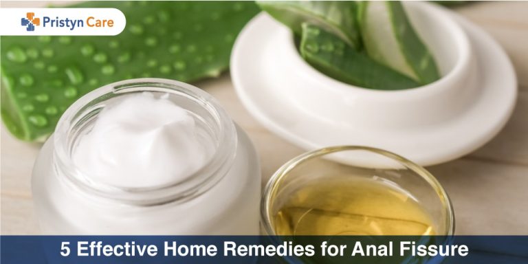 5 effective home remedies for anal fissure