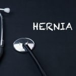 Spigelian Hernia Symptoms, Causes, Treatment