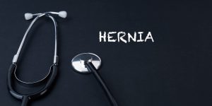 Spigelian Hernia Symptoms, Causes, Treatment