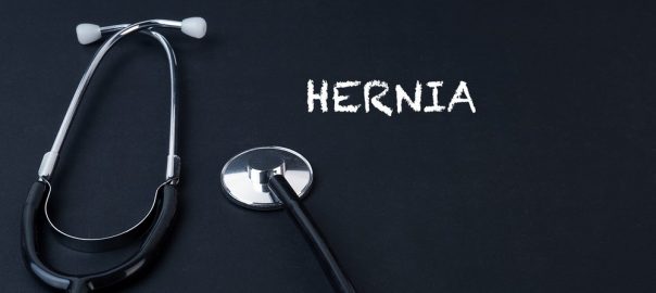 Spigelian Hernia Symptoms, Causes, Treatment
