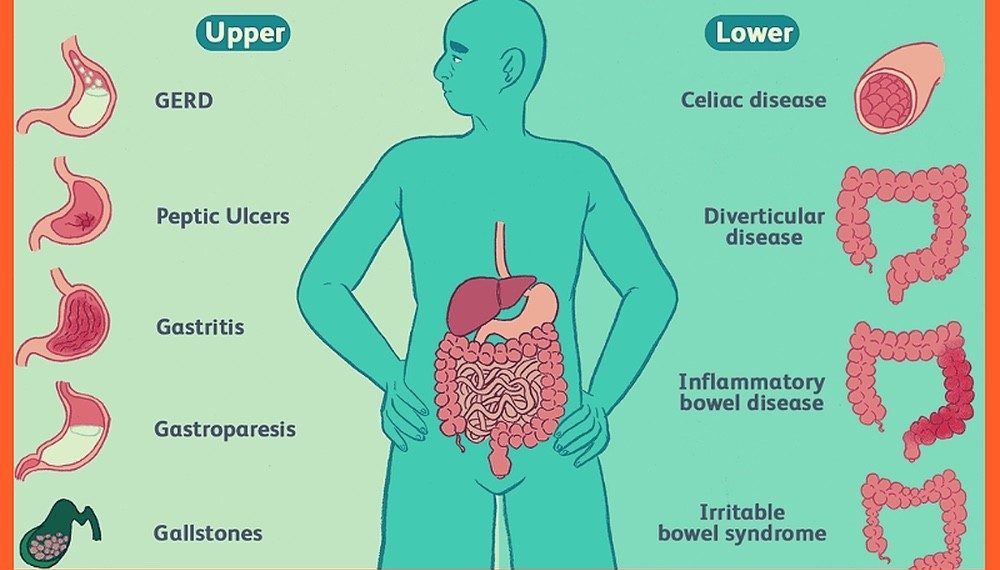 Common digestive conditions