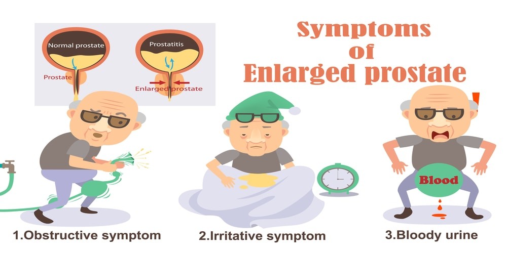 Symptoms of enlarged prostate