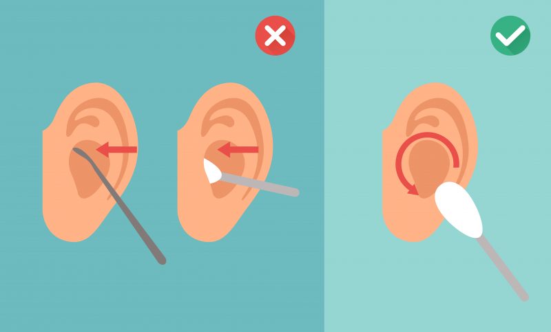 Know the Do's and Don'ts to Clean your Ears - Pristyn Care